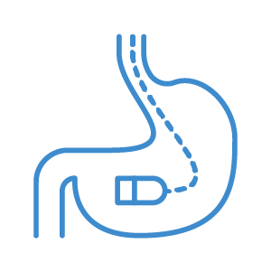 胃内視鏡検査（胃カメラ）